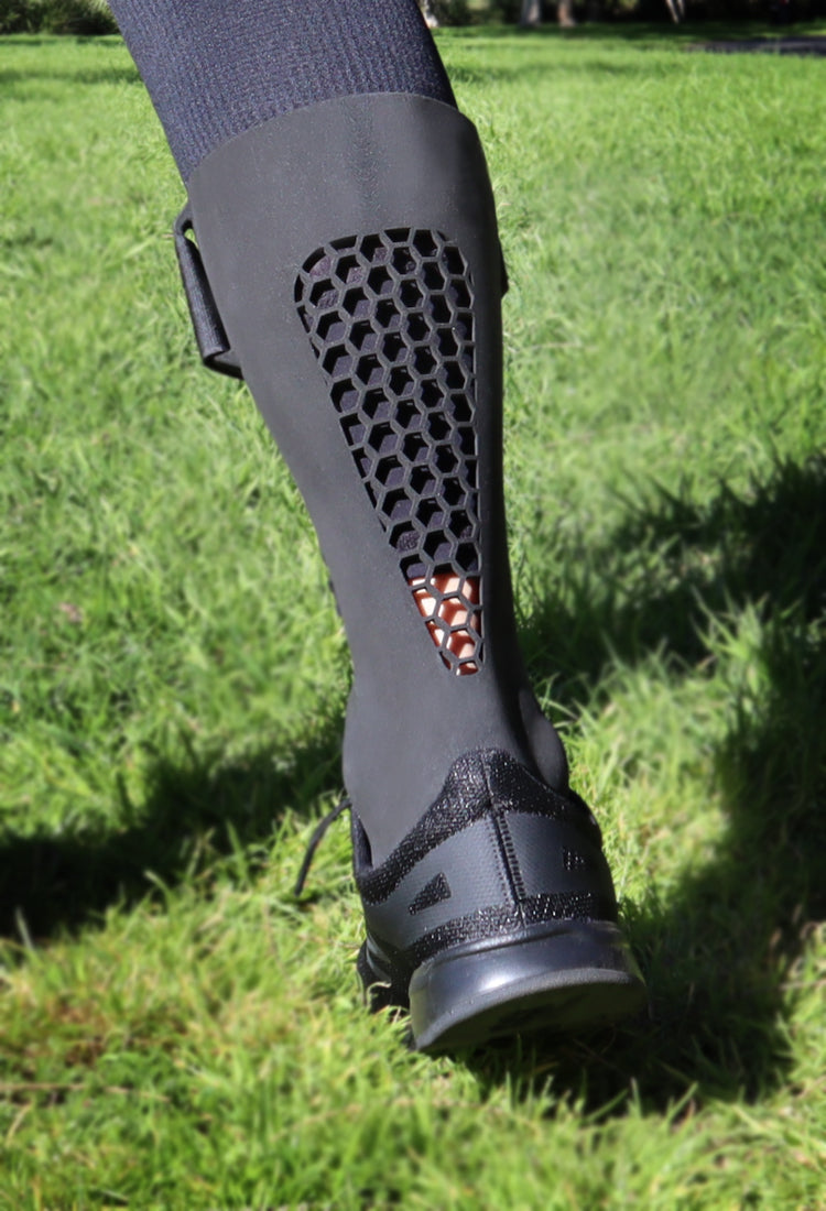 3d printed orthotics